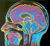 brain